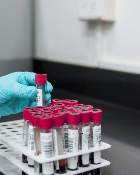 Senior die bloeduitslag bekijkt met HDL-cholesterol waarden op papier