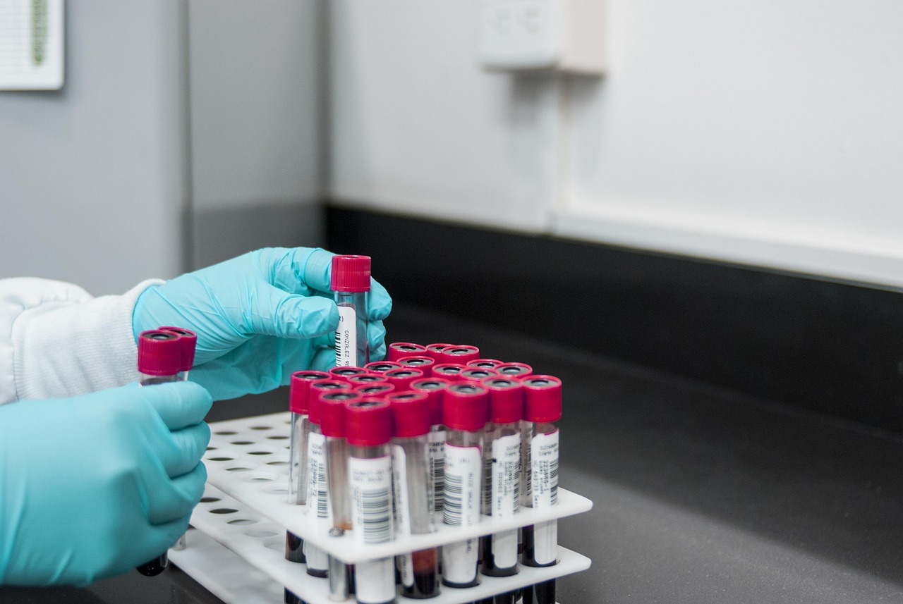 Senior die bloeduitslag bekijkt met HDL-cholesterol waarden op papier